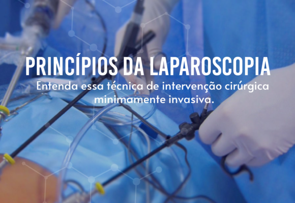 Os princípios da Laparoscopia