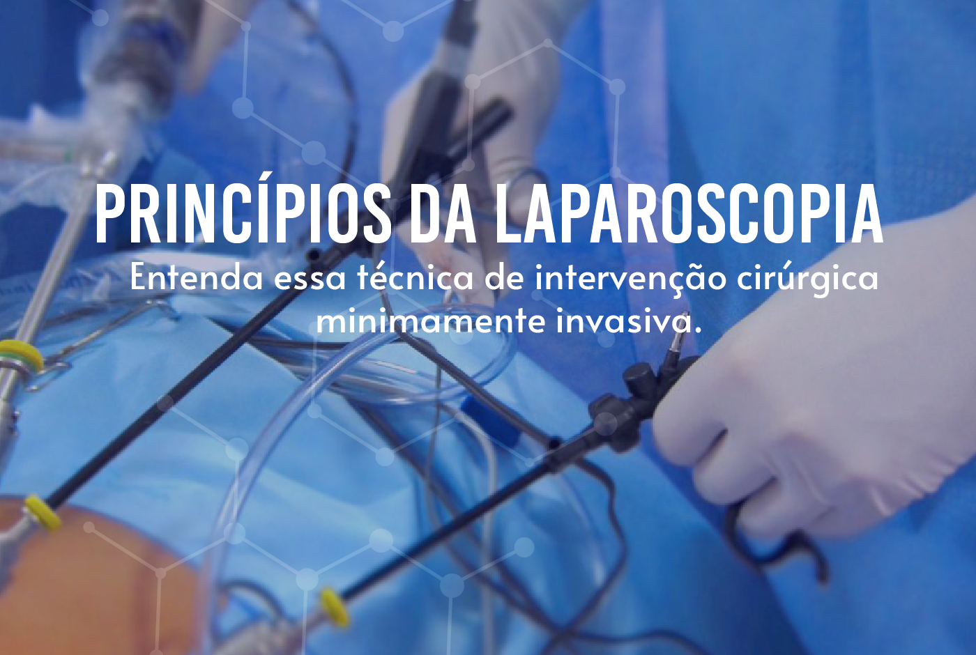 Laparoscopia: como é realizada?